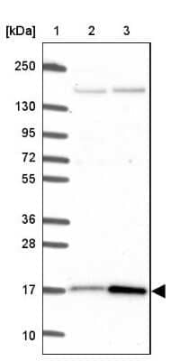 Western Blot: CutA Antibody [NBP2-39025]