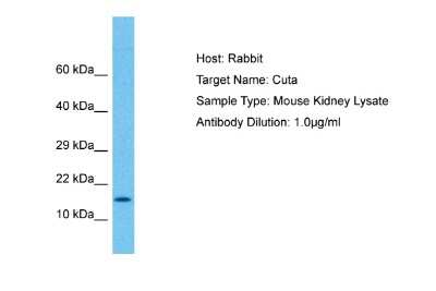 Western Blot: CutA Antibody [NBP2-84734]