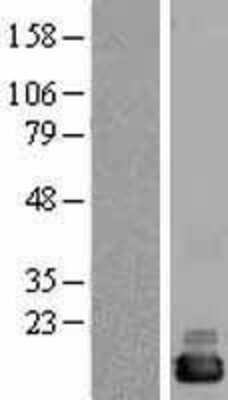 Western Blot: CutA Overexpression Lysate [NBL1-09613]