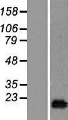 Western Blot: CutA Overexpression Lysate [NBL1-09614]