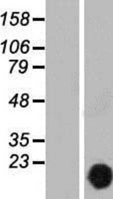 Western Blot: CutA Overexpression Lysate [NBP2-09154]