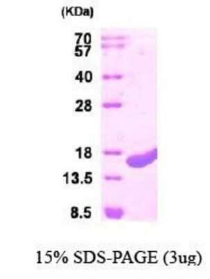 SDS-PAGE: Recombinant Human CutA His Protein [NBP1-44498]