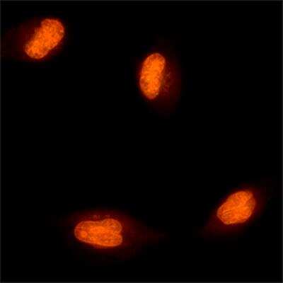 Live Imaging Microscopy: CyTRAK Orange (TM) [NBP2-81127]