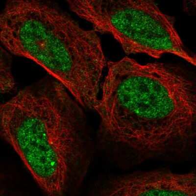 Immunocytochemistry/ Immunofluorescence: Cyclin A1 Antibody [NBP2-56070]