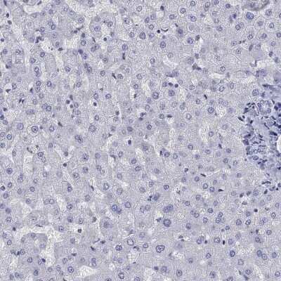 Immunohistochemistry-Paraffin: Cyclin A1 Antibody [NBP3-16995]