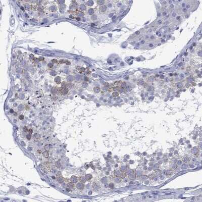 Immunohistochemistry-Paraffin: Cyclin A1 Antibody [NBP3-16995]