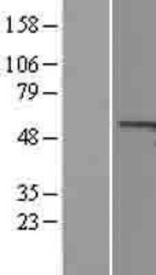 Western Blot: Cyclin A1 Overexpression Lysate [NBL1-08863]