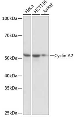 Western Blot: Cyclin A2 Antibody (3E9Z3) [NBP3-15625]