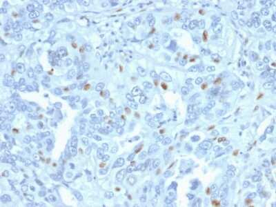 Immunohistochemistry-Paraffin: Cyclin A2 Antibody (CCNA2/2333) - Azide and BSA Free [NBP3-08789]