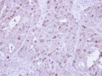 Immunohistochemistry-Paraffin: Cyclin A2 Antibody [NBP1-31330]