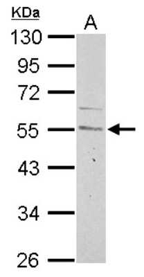 Western Blot: Cyclin A2 Antibody [NBP1-31330]