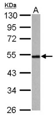 Western Blot: Cyclin A2 Antibody [NBP1-31330]