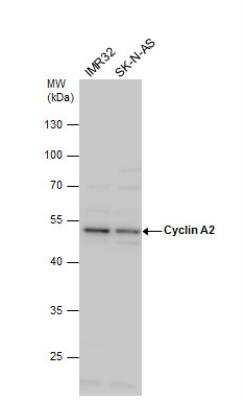 Western Blot: Cyclin A2 Antibody [NBP1-31330]