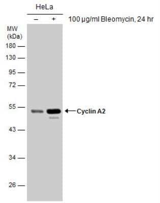 Western Blot: Cyclin A2 Antibody [NBP1-31330]