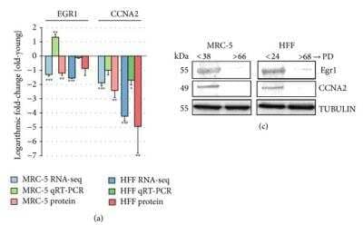 Western Blot: Cyclin A2 Antibody [NBP1-31330]