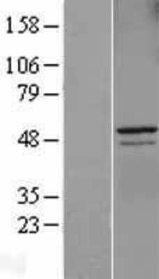 Western Blot: Cyclin A2 Overexpression Lysate [NBL1-08864]