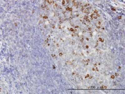 Immunohistochemistry-Paraffin: Cyclin B1 Antibody (1C8) [H00000891-M01]