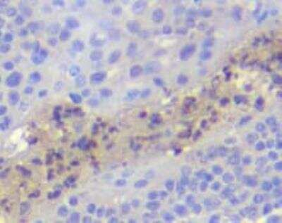 Immunohistochemistry-Paraffin: Cyclin B1 Antibody (1C8) [H00000891-M01]