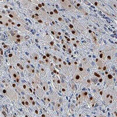 Immunohistochemistry: Cyclin B1 Antibody (2061A) - Azide and BSA Free [MAB6000]