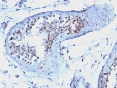 Immunohistochemistry-Paraffin: Cyclin B1 Antibody (CCNB1/1098) - Azide and BSA Free [NBP2-47893]