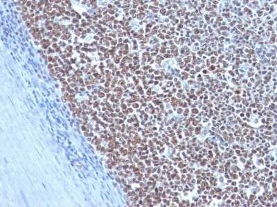 Immunohistochemistry-Paraffin: Cyclin B1 Antibody (CCNB1/1098) - Azide and BSA Free [NBP2-47893]