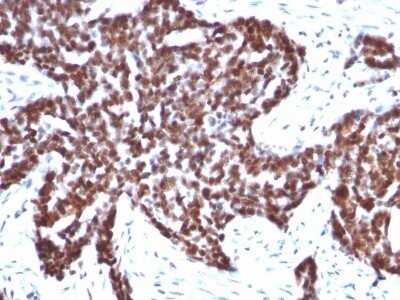 Immunohistochemistry-Paraffin: Cyclin B1 Antibody (CCNB1/1098) - Azide and BSA Free [NBP2-47893]
