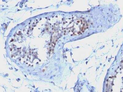 Immunohistochemistry-Paraffin: Cyclin B1 Antibody (CCNB1/1098) - IHC-Prediluted [NBP2-48117]