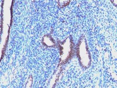 Immunohistochemistry-Paraffin: Cyclin B1 Antibody (CCNB1/1098) - IHC-Prediluted [NBP2-48117]