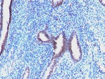 Immunohistochemistry-Paraffin: Cyclin B1 Antibody (CCNB1/1098) [NBP2-44687]