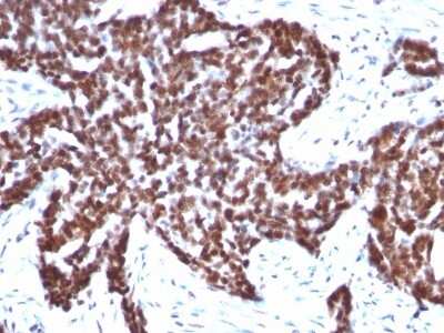 Immunohistochemistry-Paraffin: Cyclin B1 Antibody (CCNB1/1098) [NBP2-44687]