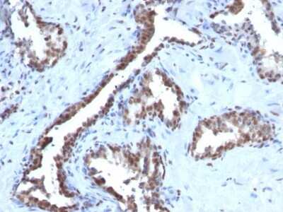 Immunohistochemistry-Paraffin: Cyclin B1 Antibody (CCNB1/1098) [NBP2-44687]