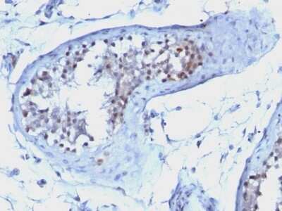 Immunohistochemistry-Paraffin: Cyclin B1 Antibody (CCNB1/1098) [NBP2-44687]