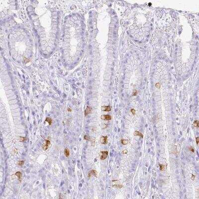 Immunohistochemistry: Cyclin B1 Antibody [NBP2-56867]