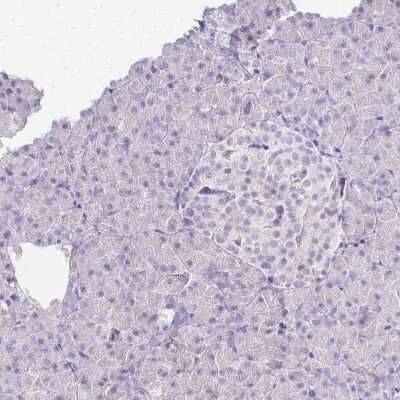 Immunohistochemistry-Paraffin: Cyclin B1 Antibody [NBP2-56867]