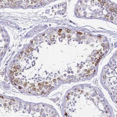 Immunohistochemistry-Paraffin: Cyclin B1 Antibody [NBP2-56867]
