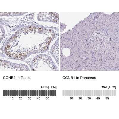 Immunohistochemistry-Paraffin: Cyclin B1 Antibody [NBP2-56867]