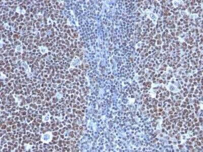 Immunohistochemistry-Paraffin: Cyclin B1 Antibody (SPM619) - IHC-Prediluted [NBP2-48126]