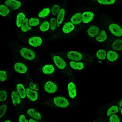 Immunocytochemistry/ Immunofluorescence: Cyclin B1 Antibody (SPM619) [NBP2-44688]