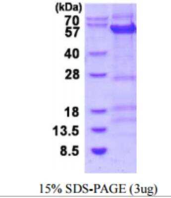 SDS-PAGE: Recombinant Human Cyclin B1 His Protein [NBP1-98919]