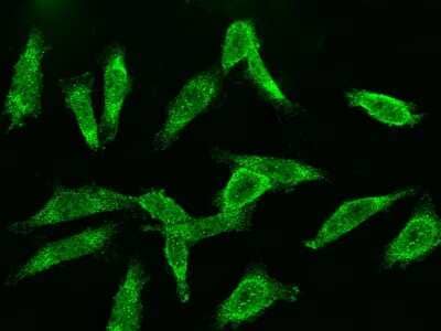 Immunocytochemistry/ Immunofluorescence: Cyclin B2 Antibody [NBP2-98962]