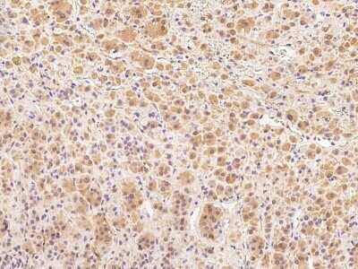 Immunohistochemistry-Paraffin: Cyclin B2 Antibody [NBP2-98961]