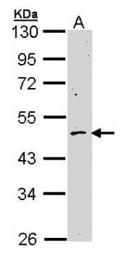 Western Blot: Cyclin B2 Antibody [NBP1-33031]