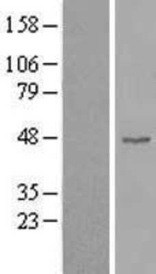 Western Blot: Cyclin B2 Overexpression Lysate [NBL1-08868]