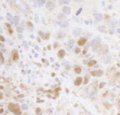 Immunohistochemistry-Paraffin: Cyclin C Antibody [NBP1-18878]