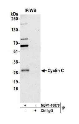Immunoprecipitation: Cyclin C Antibody [NBP1-18878]