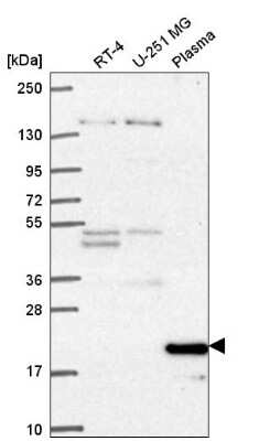 Western Blot: Cyclin C Antibody [NBP2-56402]