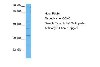 Western Blot: Cyclin C Antibody [NBP2-87235]