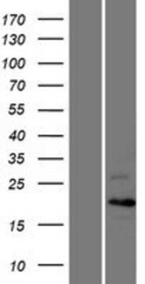 Western Blot: Cyclin C Overexpression Lysate [NBL1-08870]