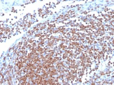 Immunohistochemistry-Paraffin: Cyclin D1 Antibody (CCND1/3370R) - Azide and BSA Free [NBP3-08955]