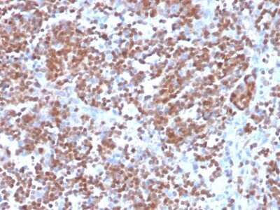 Immunohistochemistry-Paraffin: Cyclin D1 Antibody (CCND1/3370R) - Azide and BSA Free [NBP3-08955]
